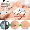 Face Massager Skin Tag Remover Electric Plasma Pen Wart Mole Removal for Neck Eyelid Freckle Nevus Dark Spot Black Dots Beauty Care 230815