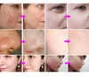 Neue kleine Blasenhydro -Dermabrasion Oxigen Strahlschale 10 in 1 Maschinen Anti -Aging -Hydrodermabrasion