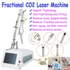Laser CO2 Treatment Skin Resurfacing Remove Freckles Vaginal Tighten Scar Removal Remove Stretch Marks Machine