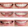 Favor de fiesta 1 par de dientes falsos de silicona Cubierta de dientes falsos superiores Sonrisa Cuidado de la dentadura Blanqueamiento de plástico oral283B