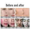 Korea Salon Use O2toDerm skin care Face Oxygen Therapy Mask Dome water Spray Jet Peel Facial Machine Derma Spa Equipment