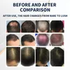 脱毛処理レーザー成長5髪の成長のための1ヘア再生レーザー頭皮トリートメントメイン650nmダイオードレーザー
