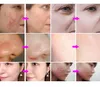 Neue 10-in-1-Gesichtspflege-Schönheitsmaschine Black Hydra Multifunktions-Gesichtsmaschine
