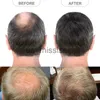 Perruques synthétiques Postiche pour hommes Patchs de cheveux latéraux ou arrière pour hommes pour couvrir la tache chauve sur le côté de la tête ou le dos 8 cm x 8 cm Patch de toupet à peau fine x0826