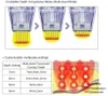 Vertical Morpheus 8 para eliminación de cicatrices Tratamiento del acné Remodelación de grasa y colágeno Eliminación de arrugas Morpheus 8