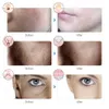 Máscara facial recarregável LED 7 cores LED Pon Terapia Máscara de beleza Rejuvenescimento da pele Home Face Lifting Whitening Beauty Device 230829