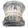 Inny model zębów zębów dentystycznych higieny jamy ustnej badające chorobę implantów z odbudową mostem Nauczanie zębów 230831