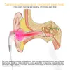 Ear Machine Articoli di bellezza Irradiazione laser Trattamento dell'acufene Problemi dell'orecchio di basso livello Risoluzione di apparecchiature per fisioterapia