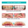 Autre hygiène bucco-dentaire Dents dentaires Détartrant Nettoyage par ultrasons Plaque dentaire Dissolvant de calculs Nettoyant dentaire sonique Enlèvement de pierre dentaire 230311