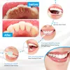 Andra orala hygieniska elektriska Sonic Dental Irrigator Tooth Calculus Remover Tandblekning Rengörare Ta bort Tartar Tänder Rengöringsverktyg 230311