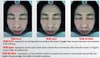 Profesyonel Cilt Teşhis Sistemi Yüz Analizörü Yüz Analizi Tarayıcı Sihirli Ayna UV Spektrum Pigment Ance Rapor Cilt Bakım Ürünleri Öner