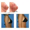 Bust Enhancer Vacuum Pump Breast Enhance Enlarge Machine for Fat Loss Butt Lifting Tightening Body Shaping Massage Enhancement