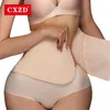 Taillenstütze CXZD Frauen Gewichtsverlust Einstellbare Atmungsaktive Trimmer Schlankheitshülle Reduzierender Gürtel Body Shaper Bauchgurt Workout Fitness