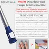 2023 980NM Diod Laser Nail Fungus Treatment 30W Spider Vener Borttagningsmaskin med kall hammare