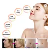 Bärbar ansiktslyftfraktionerad RF Microneedling Machine Mini Cold Hammer Skin Rejuvenation Drawing SCRE ACNE Borttagning Guldmikronedle RF Machine