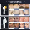 Épilateur professionnel laser 2 en 1 Diode Lasers Épilation Lightsheer saphir Glace Réduction des cheveux Traitement de l'acné