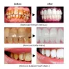 Autre détartreur dentaire à ultrasons pour l'hygiène bucco-dentaire pour les dents tartre tache dent calcul dissolvant électrique sonique dents plaque nettoyant dentaire pierre enlèvement 230524