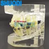 Other Oral Hygiene 1 piece Transparent Dental Orthodontic Mallocclusion Model with Brackets Archwire buccal tube for Patient Communication 230524