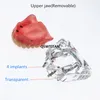 Andere mondhygiëne tandheelkundige tandenmodel met implantaten Overdenture Superior demo -model voor student tandarts Patiëntcommunicatiemodel 230524