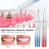 Autre hygiène bucco-dentaire éliminateur de tartre à ultrasons détartreur dentaire visuel outils de nettoyage des dents grattoir pour enlever la pierre dentaire 230524