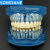 Other Oral Hygiene 1pc Dental Standard Tooth Model Orthodontic Model for Patient Communication Dental Study Clinic Model Tool Unremovable Teeth 230524