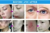 Hot Sales 2IN 1 Professional RF Equipment Facial Skin Tightening Freckle Removal Eyelid Lifting Plasma Beauty Machine