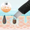 Tool Ultrasone Huid Scrubber Diepe Gezicht Reinigingsmachine Peeling Schop Facial Pore Cleaner Gezicht Huid Scrubber Lift Machine Schoo