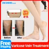 Soins varicose veines chaussettes de compression Traitement de la vascularite inflammation phlébite jambes varicosité angiite collants bas