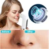 Ansiktsvårdsenheter Electric Small Bubble Blackhead Remover USB Water Cycle Pore Acne Pimple Removal Vakuum Sug Nosen renare verktyg 231130