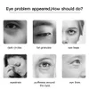 Masajeador de ojos EMS Instrumento de belleza Ultrasónico RF Eliminación de arrugas Ojeras Levantamiento Estiramiento y rejuvenecimiento Masajeador para el cuidado de la piel 231220