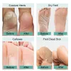 Foot Rasps Electric Callus Remover For Feet Rechargeable Sandpaper Pedicure Vacuum File Hard Dead Skin 230701