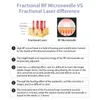 Goede RF Fractional Laser Micro-naaldverwijdering en verwijdering van striae Microneedling-gezichtsbehandeling