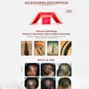 5 Diyot Lazer Saç Yeniden Çarşamba Ekipmanı Proaktive Saç Folikülü Hızlı Büyüme Kafası Fotonherapi Fırça Masajı için Düşük Seviye Soğuk Büyüme LED Işık Terapisi