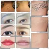 Macchina per la rimozione dei tatuaggi laser a picosecondi Nd Yag Trattamento per bambole nere Attrezzatura per la cura del viso Ringiovanimento della pelle