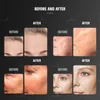 EMS Face Lifting Beauty Machine Skin Tightening Lift Sagging Skin Anti-Aging Beauty Device EMS Face Lift EMS Facial Device