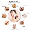 Massageador Facial Radiofrequência EMS Massageador de Alta Frequência RF Microcorrente Lift Skin Tightening Remover Rugas Aparelho de Beleza 230718