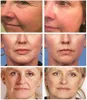 Dispositivos para cuidados faciais Massageador Facial para os Olhos Vibração Elétrica Antienvelhecimento Antirrugas Promover Nutrição Remoção de Inchaço para Fadiga Ocular 230717