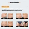 Réduction des graisses Élimination de la cellulite Lifting du visage RF + MDS Modelage du corps Rajeunissement du corps Rajeunissement de la peau Dispositif amincissant pour le corps en cellulite