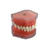 Andere Mundhygiene-Zahnmodell, abnehmbares Zahnmodell, abnehmbares Implantat, weiches Zahnfleisch, Zahnmodell, Zahnarzt, Lehre, Forschung, Zahnmedizin, TYPODONT Modell 230720