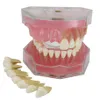 Soral Dental Implant Teeth Model Study Lär standardmodell med avtagbara tänder269j