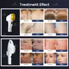 Snabb leverans Ny 808nm Diode Laser Permanent Hårborttagningsmaskin IPL OPT Hud Rejuvenation Beauty Salon Use