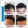 Bangs JINKAILI Synthetic Forehead Hairline Toupees Men's Straight V Style Hair Piece Hair Extension Natural Black Hair Bangs Hairpiece 230724