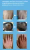 Dispositivos para el cuidado de la cara 311nm UVB Light Potherapy para Vitiligo Psoriasis Eczema Problemas de la piel Tratamiento Lámpara ultravioleta 230728