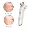 Masseur de visage KinseiBeauty Plasma Soins de la peau Beauté Machine Ozone Acné Supprimer Anti-acné Stérilisation Éclaircissant Masseurs Appareils 230728