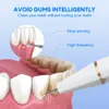 Andere Mundhygiene Elektrischer Zahnsteinreiniger Dental Hochfrequenzvibration Schallzahnaufhellung Plaque-Entferner Zahnsteinschaber Mundhygiene 231101