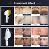 Dernier IPL 5 longueurs d'onde filtre 530NM rajeunissement de la peau épilation Diode Laser élimination des pigments Machine de beauté USB verrouillage de sécurité personnalisable