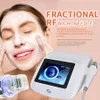 Articoli di bellezza RF Microneedle Fractional RF Beauty Machine Ringiovanimento della pelle Anti smagliature Acne Rimuovi