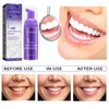 V34 سلسلة تنظيف الأسنان موس معجون أسنان الأسنان نظيفة الأسنان طازجة معجون أسنان الأسنان أبيض منتج تنظيف الأسنان