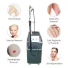 أفضل منتج مبيعًا Super 1064 Long Pulse nd Yag Laser Removal Machine