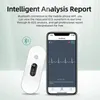 Andra hälsoskönhetsartiklar ER2 PORTABLE EKG Monitor OLED Bluetooth EKG Cardiaco hjärtövervakning bärbar elektrokardiograma Unlimited Data Storage Dela 231110